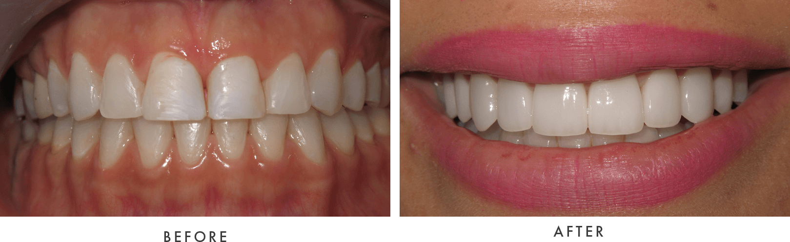 cosmetic dentistry before and after