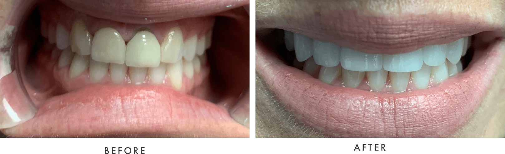 cosmetic dentistry before and after