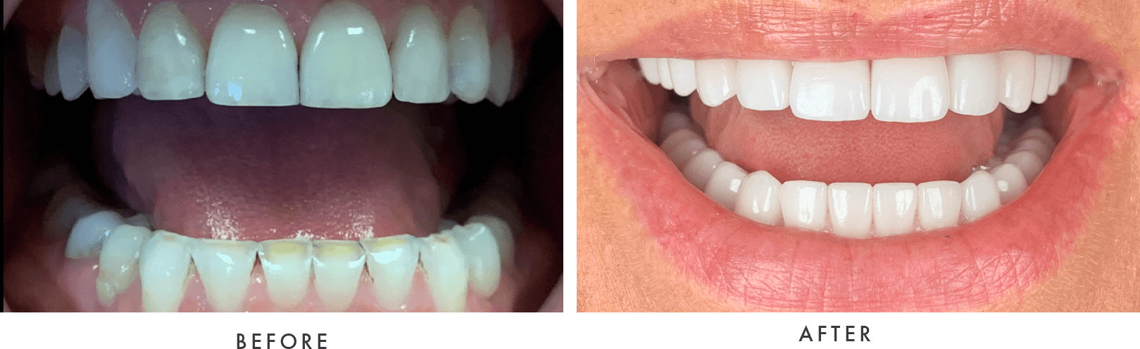 cosmetic dentistry before and after