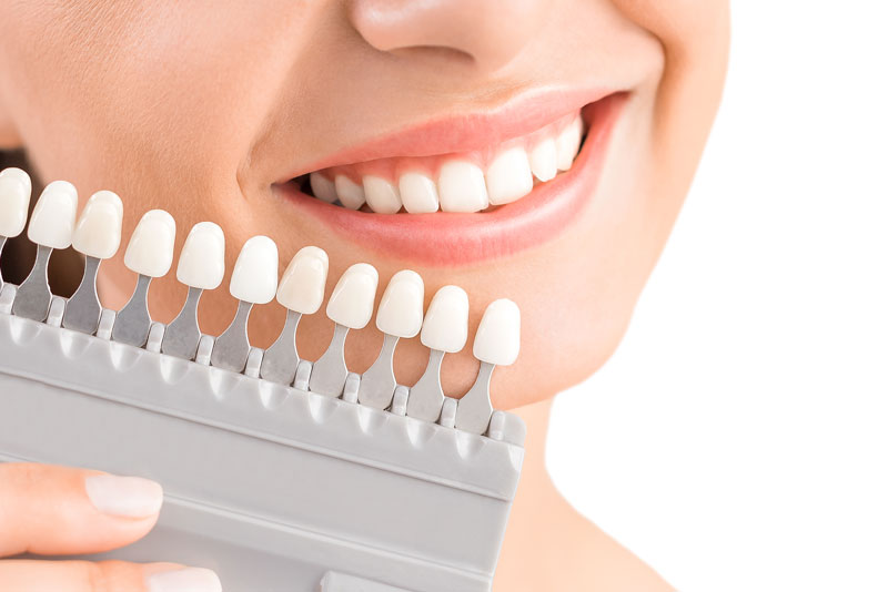 a dental patient smiling while holding a rack of porcelain veneers by her mouth