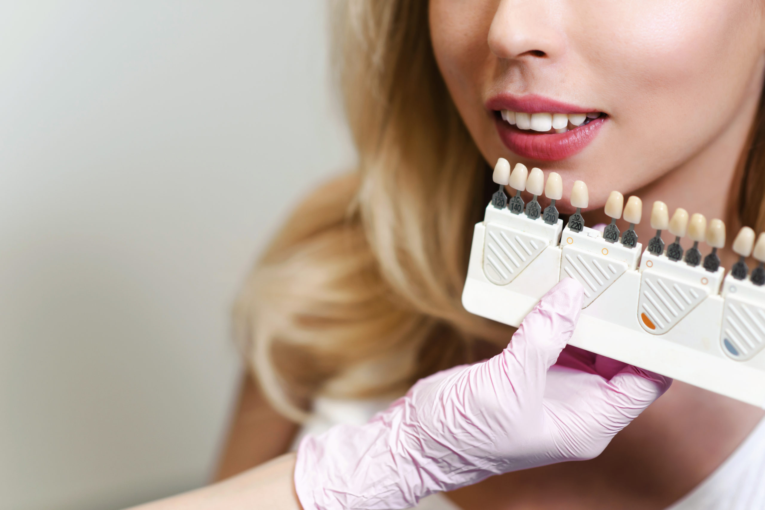 a dental patient smiling and comparing veneer shells against a smile