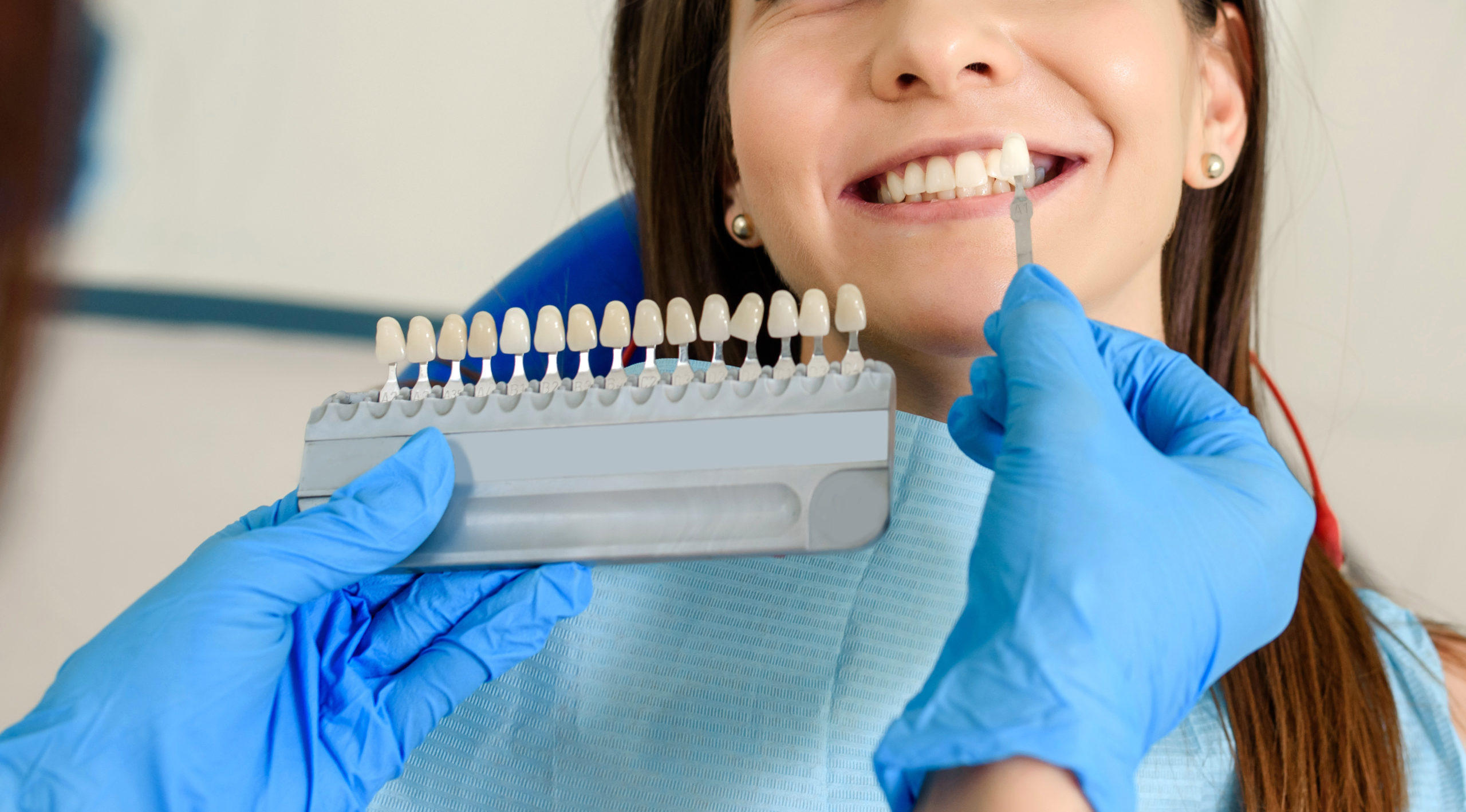 a dental patient smiling while holding a rack of porcelain veneers by her mouth