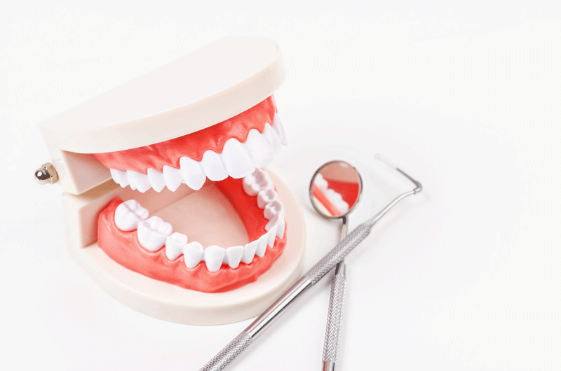 a full mouth dental implant model shown with some dental tools.
