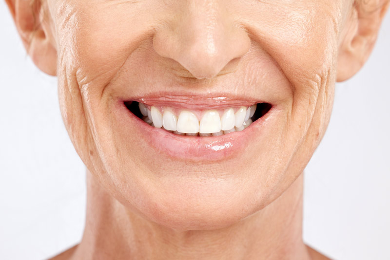Am I A Candidate For Porcelain Veneers?