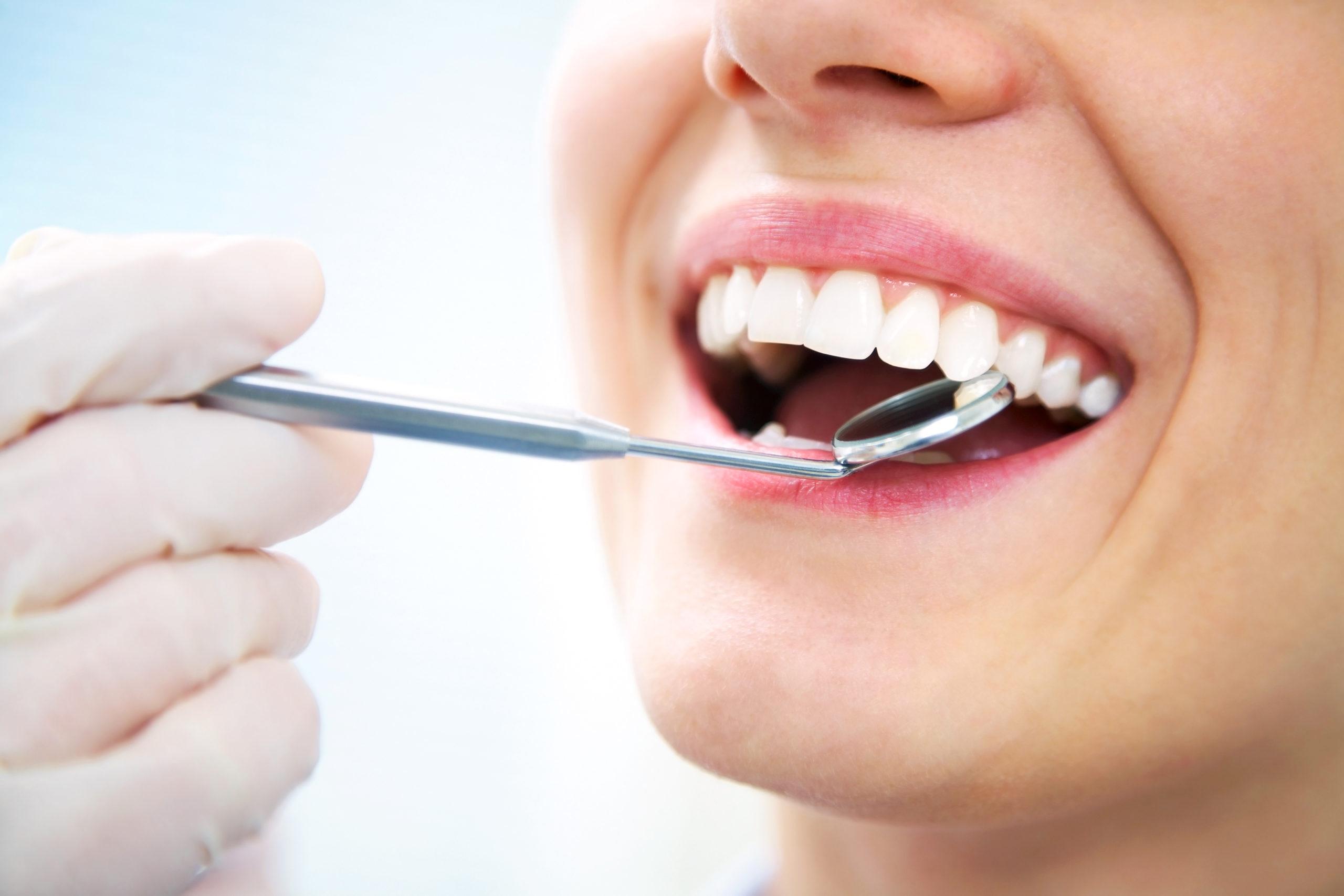 an image of a woman smiling after getting a teeth whitening service