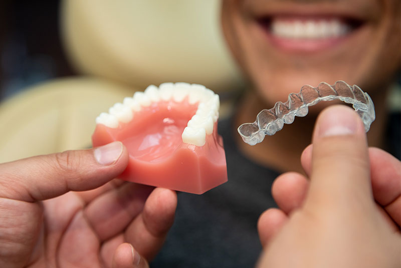 Invisalign clear aligners