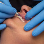 Cosmetic dentist Dr. Ashkan Haeri cleans and whitens dental patients teeth.